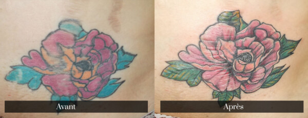 Recouvrement d'un tatouage de pivoine. Amélioration des tracés, ombrages et texture des pétales et des feuilles du tatouage.